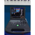 Preço de ultra-som doppler colorido portátil &amp; ecografia DW-C60